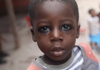 A young child wearing traditional chilo eyeliner in Ghana, gazing intensely into the camera.