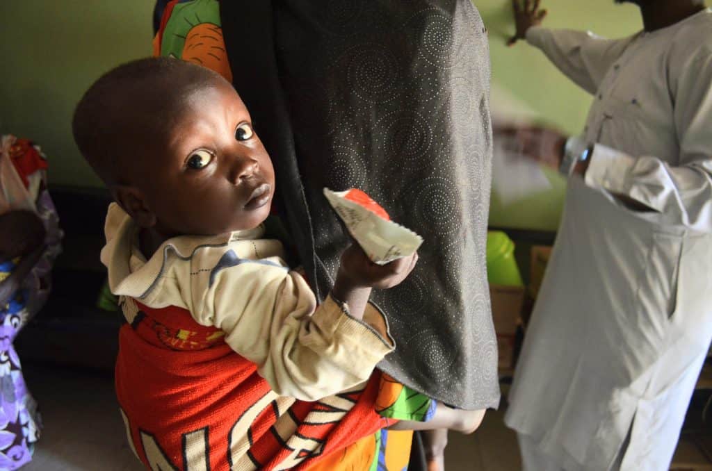 A child receiving aid in a community setting, looking at the camera with curiosity.